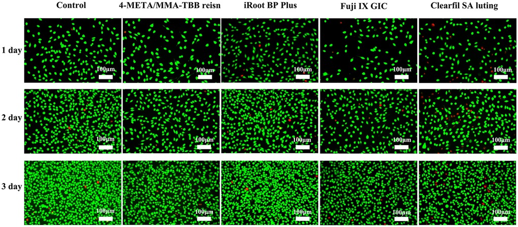 Fluorescent microscopy images showing cell cultures over three days. Columns represent different treatments: Control, 4-META/MMA-TBB resin, iRoot BP Plus, Fuji IX GIC, and Clearfil SA luting. Rows correspond to 1, 2, and 3 days. Green indicates live cells, while red indicates dead cells. Scale bar is 100 micrometers.
