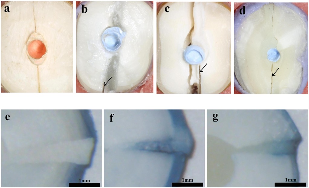 Sequential images labeled a to d depict cross-sections of reattached roots after fracture loading, with arrows indicating fracture sites. Images e to g show microleakage of three materials. Specifically, a is the control group, b and e are the 4-META/MMA-TBB resin group, c and f are the Fuji IX GIC group, and d and g are the Clearfil SA Luting group. All images includes scale bars labeled