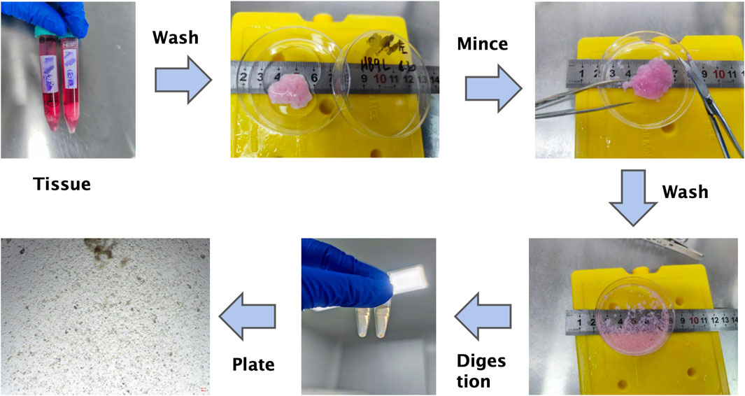 Process of tissue preparation for microscopic analysis. Sequential steps include: starting with tissue in tubes, washing the tissue, mincing it on a dish with a ruler for scale, washing again, digesting the minced tissue in centrifuge tubes, and finally plating the digested tissue. Arrows indicate the flow of the process.