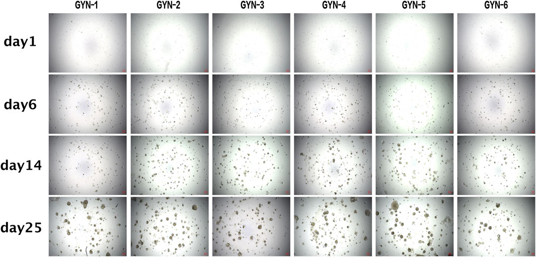 Microscopic images show cell cultures GYN-1 to GYN-6 over four time points: day 1, 6, 14, and 25. Early images show sparse cells, gradually increasing in density and clustering, with significant aggregate formation by day 25.