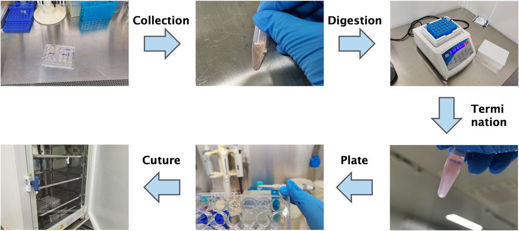 Flowchart illustrating a laboratory procedure with six steps: Collection, Digestion, Termination, Culture, Plate. Each step includes a relevant image, such as a sample collection, digestion using a centrifuge, termination, culture chamber, and plates being held. Arrows indicate the process sequence.