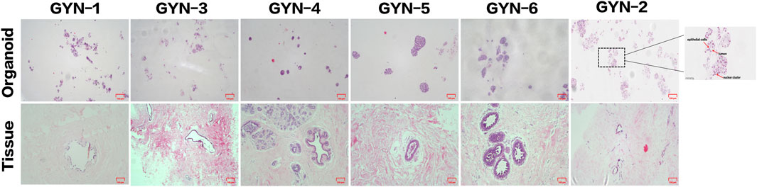 Microscopic images of organoids and tissues labeled GYN-1 to GYN-6. The top row shows organoid samples with varying cluster sizes of purple-stained cells. GYN-2 includes a magnified section highlighting epithelial cells, lumen, and nuclear clusters. The bottom row displays tissue sections, each with distinct cellular and structural features. Scale bars indicate 100 micrometers.
