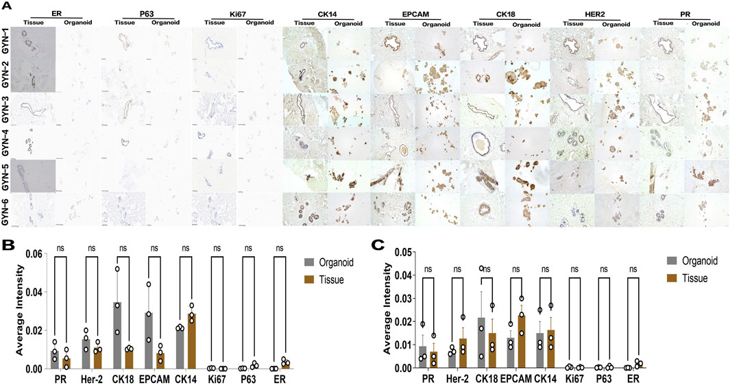 A composite of histological images and bar graphs. Part A shows immunohistochemical staining of various markers (ER, P63, Ki67, CK14, EPCAM, CK18, HER2, PR) in tissue and organoid samples labeled GYN-1 to GYN-6. Parts B and C display bar graphs comparing average intensity levels for each marker between organoids (gray) and tissues (brown), with