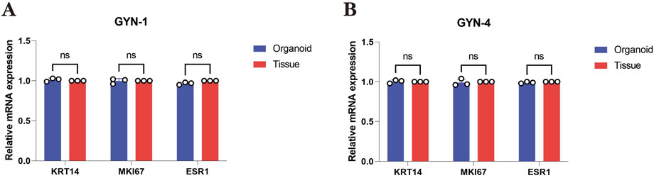 Bar charts comparing relative mRNA expression of KRT14, MKI67, and ESR1 between organoid and tissue samples for GYN-1 and GYN-4. Organoid samples are in blue and tissue samples in red. Both charts show no significant differences (ns) across all genes.