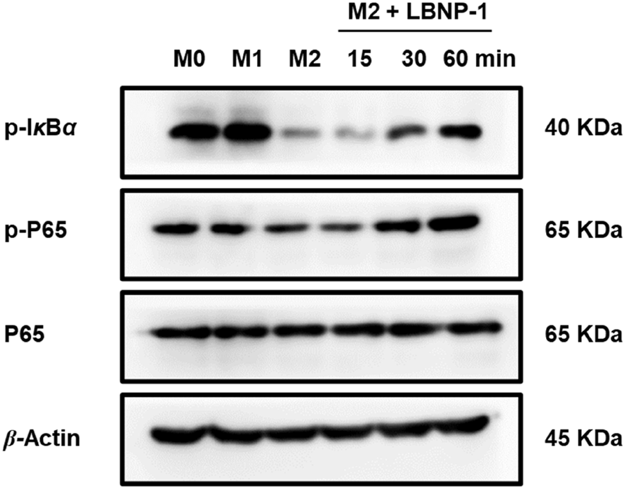Western blot analysis showing protein expression levels for p-IκBα, p-P65, P65, and β-Actin across different conditions and times. Bands correspond to molecular weights of 40, 65, and 45 KDa, respectively.