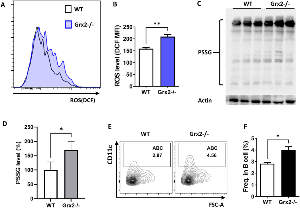 Aged Grx2 knockout mice have increased ABC differentiation. (A) Representative flow cytometry histogram plot showing ROS levels in splenic ABCs of 18-month-old female WT (solid line) and Grx2−/− (shaded) mice; (B) Bar graph of data from the panel A experiment (n = 3). (C) Protein glutathionylation level evaluated by Western blot after separation with non-reducing SDS-PAGE. Western blot of Actin was used as loading control. (D) Bar graph of PSSG levels represented by ratio of grayscale values of PSSG versus loading control for each sample in the panel C experiment, and the WT mean value was set as 100% (n = 3). (E,F) Representative flow cytometry profile (E) and bar graph (F) showing the percentage of ABC among splenic B lineage (B220⁺CD19⁺) cells of the aged WT and Grx2−/− mice (n = 3). Data are represented as mean ± SEM. Unpaired t-test was used in panel B, D and F. *p < 0.05, **p < 0.01.