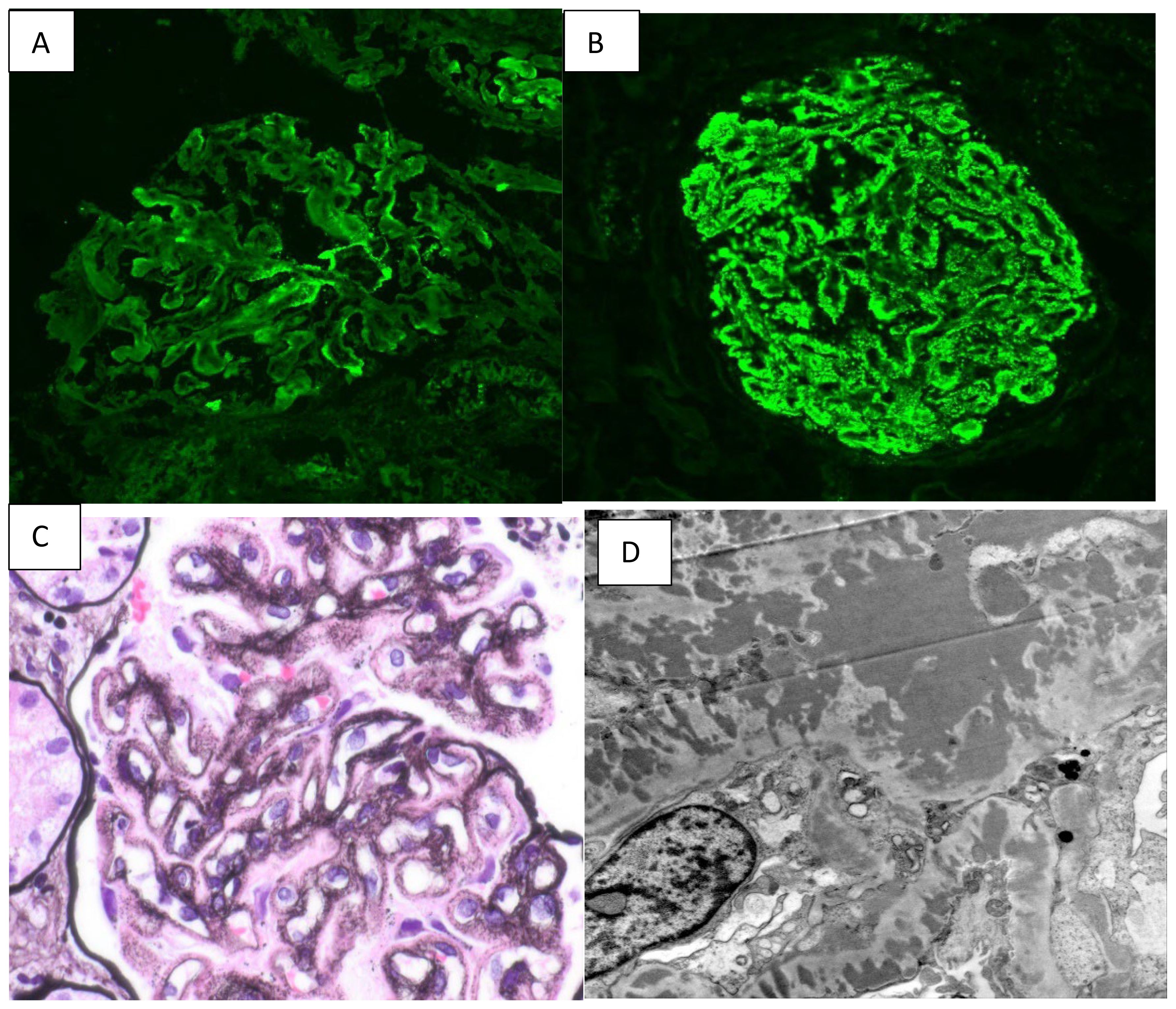 Panel A shows a fluorescent image with a network pattern in green. Panel B displays another fluorescent image with a more condensed and circular green pattern. Panel C is a light microscope image showing intricately stained tissue structures in purple and pink. Panel D presents an electron microscope image with detailed cellular structures in grayscale, highlighting organelles and cellular membranes.