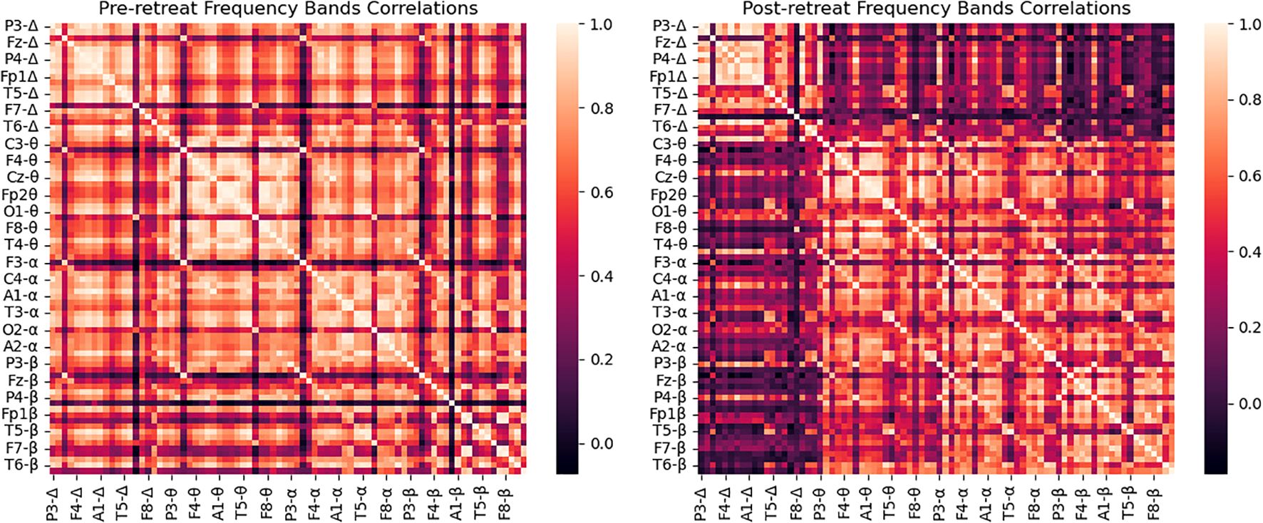 Heatmaps showing correlations of frequency bands, labeled with electrode sites and frequency bands, pre-retreat on the left and post-retreat on the right. Color scale on the right indicates correlation strength from dark (low) to light (high).