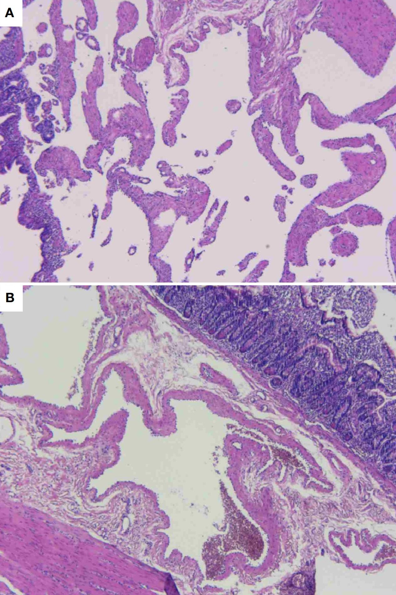 Histological images labeled A and B. A shows irregular, purple-stained tissue structures with clear spaces between them. B displays a more organized tissue pattern, with denser, darker staining on the top right, indicating varied layers of cellular structure. Both images are stained for cellular examination.