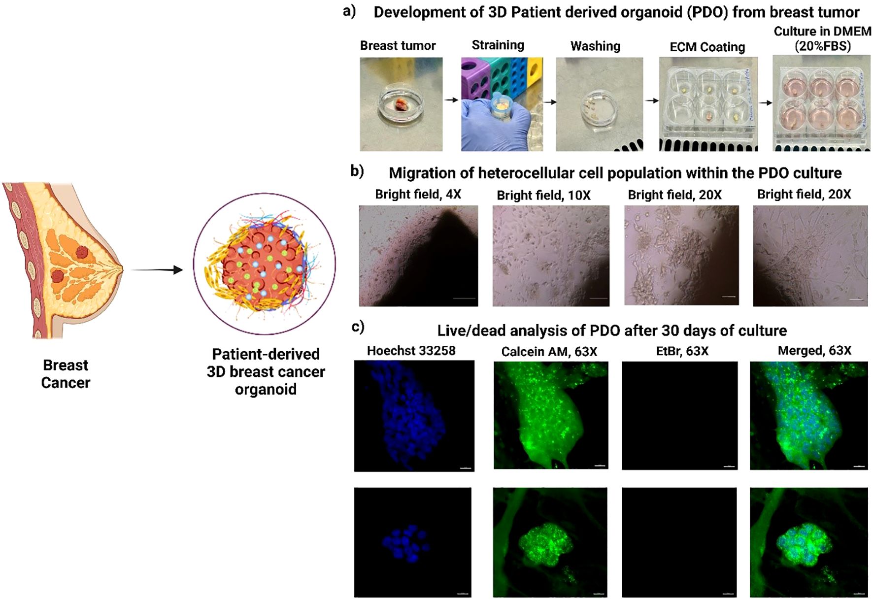 Diagram illustrating the development and analysis of patient-derived 3D breast cancer organoids (PDO). Part a) shows the PDO creation process from breast tumor to growth in culture. Part b) displays bright-field microscope images at different magnifications, depicting cell migration within the PDO. Part c) presents live/dead analysis after 30 days, featuring fluorescent staining with Hoechst 33258, Calcein AM, and EtBr, and merged images, highlighting live cell viability.