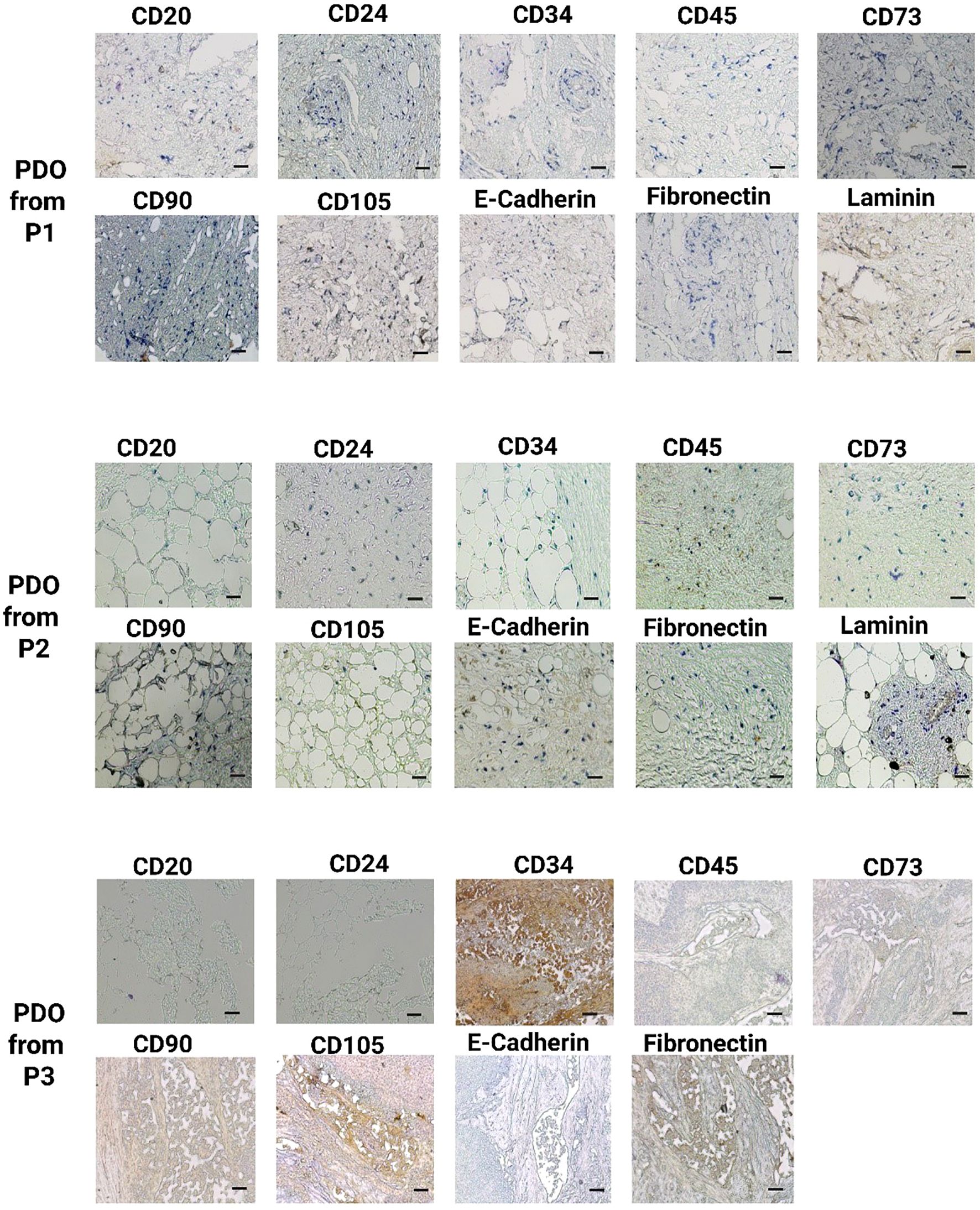 Three rows of microscopic images labeled as PDO from P1, P2, and P3, each showing different markers: CD20, CD24, CD34, CD45, CD73, CD90, CD105, E-Cadherin, Fibronectin, and Laminin. Each row represents various staining patterns and tissue structures observed under a microscope.