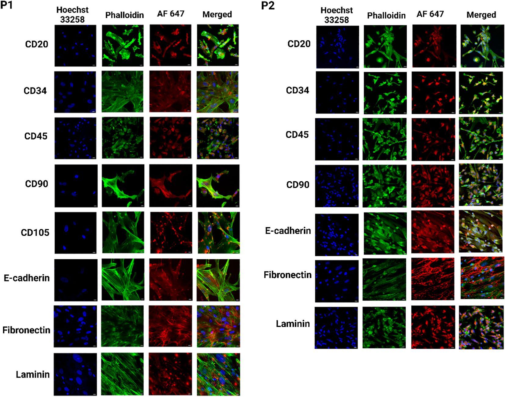 Microscopic images showing immunofluorescence staining of two sample sets (P1 and P2). Each set displays staining for markers CD20, CD34, CD45, CD90, CD105, E-cadherin, Fibronectin, and Laminin. Columns show Hoechst 33258, Phalloidin, AF 647, and Merged images. Hoechst shows nuclei in blue, Phalloidin highlights the cytoskeleton in green, and AF 647 marks specific markers in red, with merged images displaying the combined staining.
