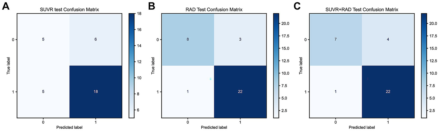 Three confusion matrix panels labeled A, B, and C. Panel A shows SUVR test with 5 true positives, 6 false positives, 5 false negatives, and 18 true negatives. Panel B shows RAD test with 8 true positives, 3 false positives, 1 false negative, and 22 true negatives. Panel C shows SUVR+RAD test with 7 true positives, 4 false positives, 1 false negative, and 22 true negatives. Each panel uses a blue gradient to indicate values.