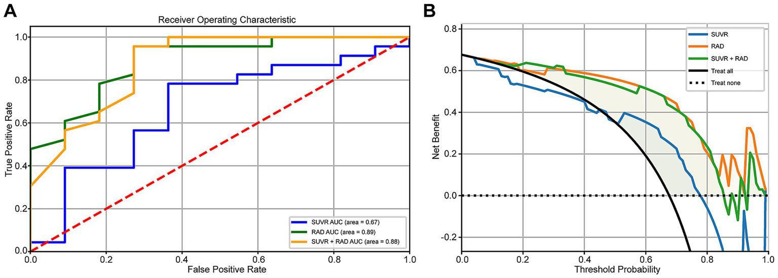 Panel A shows a Receiver Operating Characteristic (ROC) curve with True Positive Rate against False Positive Rate. Three lines represent SUVR, RAD, and SUVR + RAD, with areas of 0.67, 0.89, and 0.88 respectively. Panel B presents a Decision Curve Analysis with Net Benefit against Threshold Probability, comparing SUVR, RAD, SUVR + RAD, and baseline strategies "Treat all" and "Treat none".