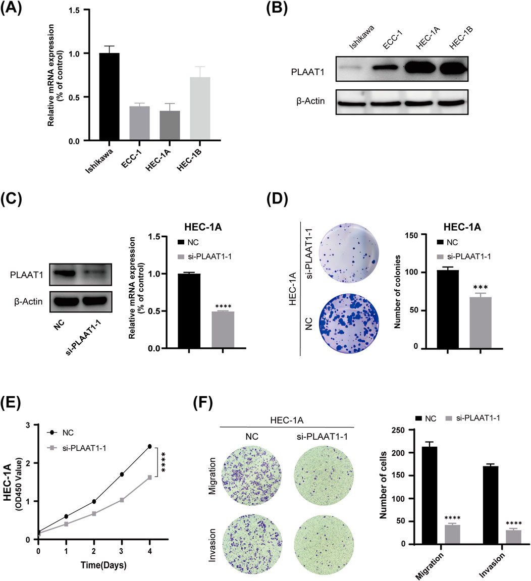 (A) Bar graph comparing relative mRNA expression of PLAAT1 across Ishikawa, ECC-1, HEC-1A, and HEC-1B. (B) Western blot showing PLAAT1 and β-Actin levels in the same cell lines. (C) Western blot and bar graph illustrating reduced PLAAT1 expression in HEC-1A cells treated with si-PLAAT1-1 versus NC. (D) Colony formation assay with fewer colonies in si-PLAAT1-1 treated HEC-1A. (E) Line graph showing decreased growth in si-PLAAT1-1 treated HEC-1A over four days. (F) Images and bar graph demonstrating reduced migration and invasion in si-PLAAT1-1 treated cells compared to NC.
