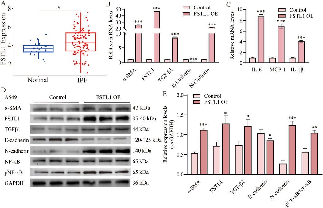 Graphs and a western blot image show FSTL1 expression analysis. Panel A: Box plot of FSTL1 expression in normal versus IPF samples. Panels B and C: Bar graphs of mRNA levels for various genes in control and FSTL1 OE. Panel D: Western blot depicting protein expression in A549 cells, comparing control and FSTL1 OE. Panel E: Relative expression levels versus GAPDH shown in a bar graph. Statistical significance is indicated with asterisks.