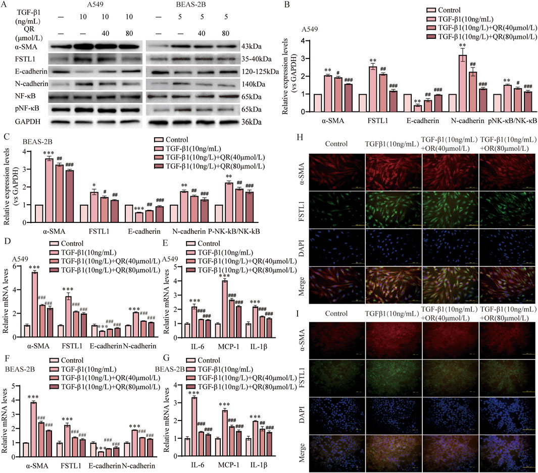 The image presents a series of experimental results demonstrating the effects of TGF-β1 and QR on protein expression in A549 and BEAS-2B cells. Panel A shows Western blot images for proteins such as α-SMA, FSTL1, and various cadherins. Panels B, C, D, E, F depict bar graphs highlighting relative expression levels and mRNA levels of these proteins under different treatment conditions. Panels H and I display immunofluorescence images showing protein localization, with stained markers for α-SMA, FSTL1, and DAPI under different conditions. Detailed statistical significance is noted with asterisks and hash symbols.