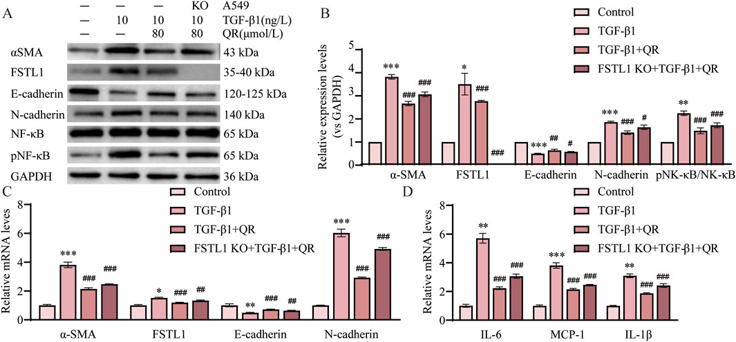 Western blot and bar graphs depict the expression of proteins and mRNA levels in different experimental conditions. Panel A shows bands for proteins like α-SMA, FSTL1, and E-cadherin under various treatments. Panels B to D present bar graphs illustrating relative expression levels and mRNA levels for α-SMA, E-cadherin, and others, comparing Control, TGF-β1, TGF-β1+QR, and FSTL1 KO+TGF-β1+QR groups. Statistical significance is indicated by asterisks and hashes.
