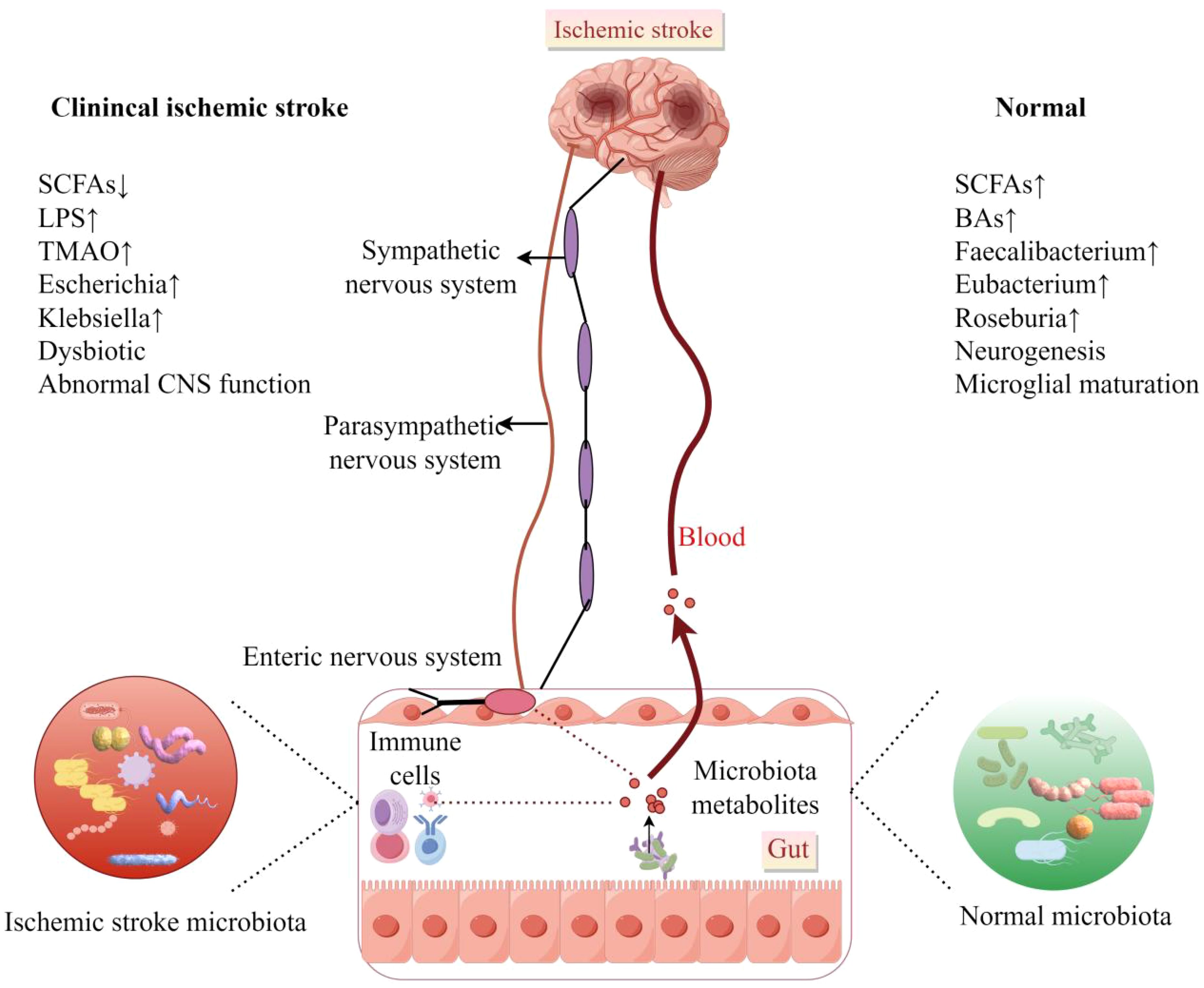 Diagram illustrating the differences in microbiota and nervous system interactions between clinical ischemic stroke and normal conditions. The left side shows decreased short-chain fatty acids (SCFAs) and increased lipopolysaccharides (LPS), TMAO, Escherichia, and Klebsiella with abnormal CNS function. The right side shows increased SCFAs, bile acids (BAs), and beneficial bacteria like Faecalibacterium, indicating neurogenesis and microglial maturation. Both pathways involve the enteric, sympathetic, and parasympathetic nervous systems and microbiota metabolites affecting the brain.