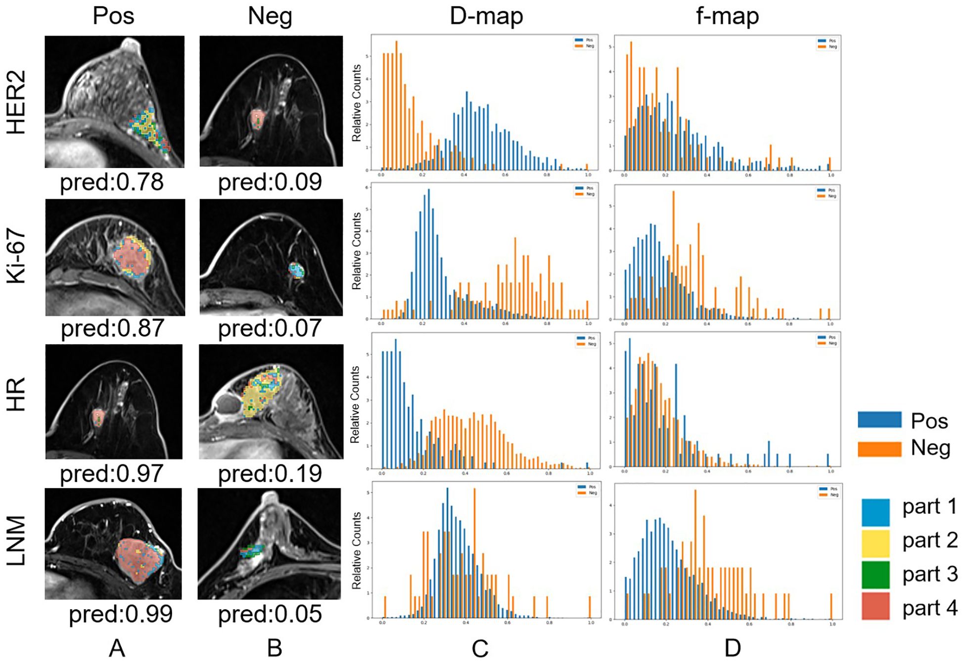 MRI images and bar charts illustrate features of breast cancer markers HER2, Ki-67, HR, and LNM. Each row shows a positive (Pos) and negative (Neg) MRI, followed by two bar charts labeled D and F, comparing metrics for Pos and Neg outcomes. The bar colors represent Pos (blue) and Neg (orange), with segments in parts 1 to 4 colored blue, orange, yellow, green, and red.