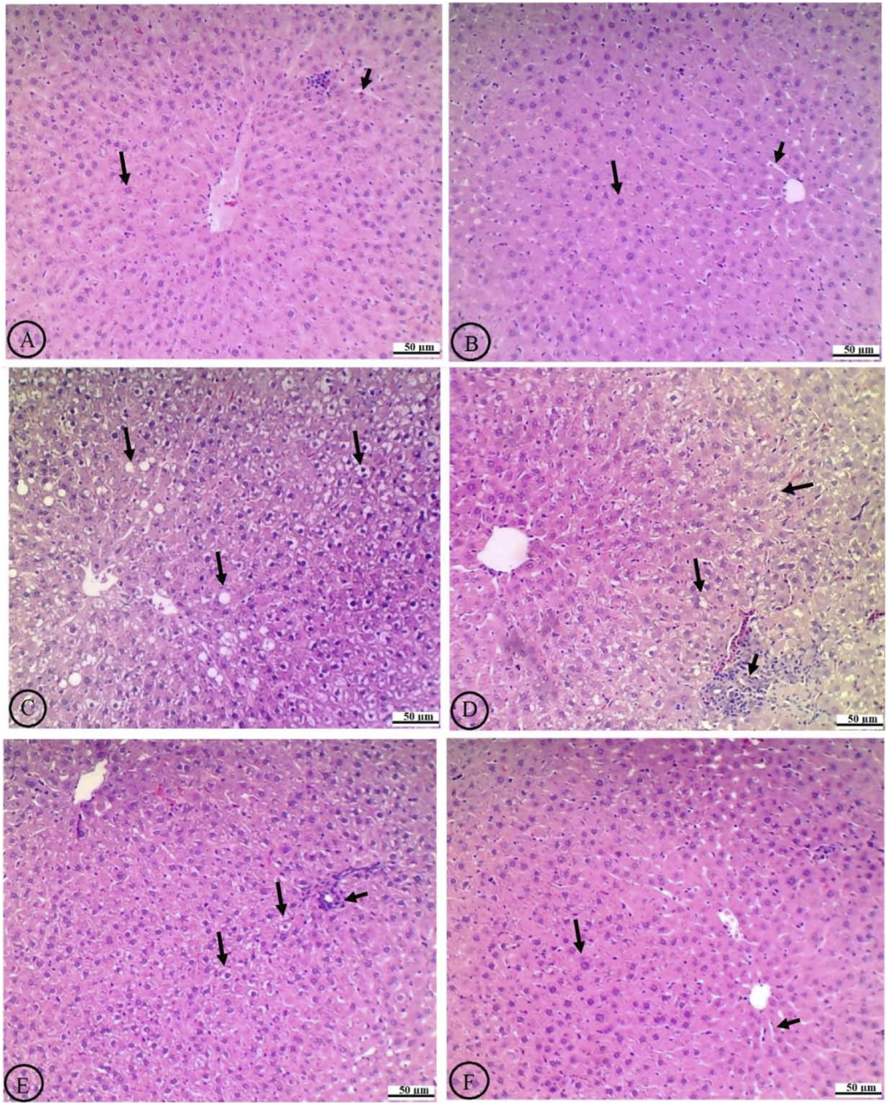 Microscopic images of liver tissue sections labeled A to F. Each section shows variations in cellular structure and staining intensity. Arrows indicate specific regions or structures within the tissue, such as cell clusters or areas of degeneration. The scale bar in each image measures fifty micrometers.