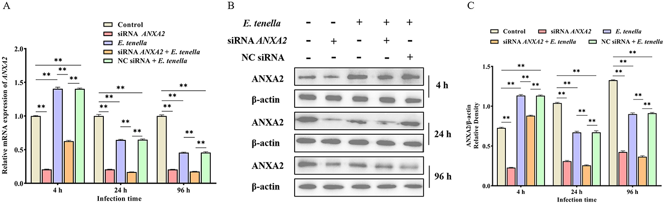 Panel A shows a bar graph of relative mRNA expression of ANXA2 over three infection times (4, 24, and 96 hours) for various treatments, with significant differences marked. Panel B displays Western blot results showing ANXA2 and -actin levels under different conditions at the same time points. Panel C presents a bar graph of ANXA2/-actin relative protein density, again showing significant differences across treatments and times.
