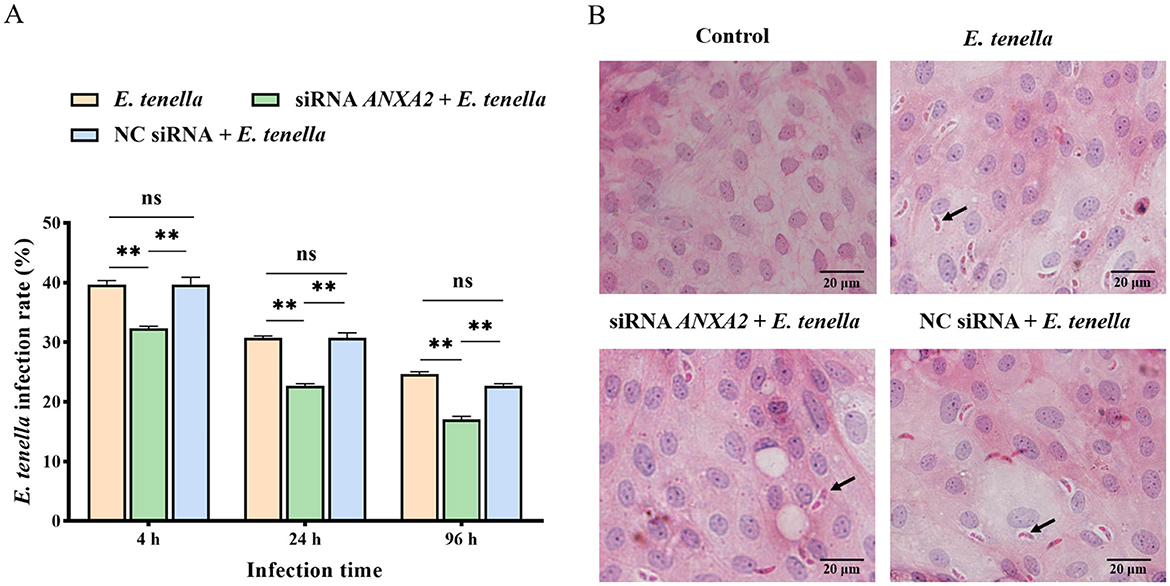 Graph A shows the infection rate of *E. tenella* over 4, 24, and 96 hours, comparing conditions: *E. tenella* alone, with siRNA ANXA2, and with NC siRNA. Significant differences are marked. Images B display histological samples under different conditions: Control, *E. tenella*, siRNA ANXA2 +*E. tenella*, and NC siRNA +*E. tenella*, with arrows indicating specific points of interest. Each image includes a scale bar of 20 micrometers.