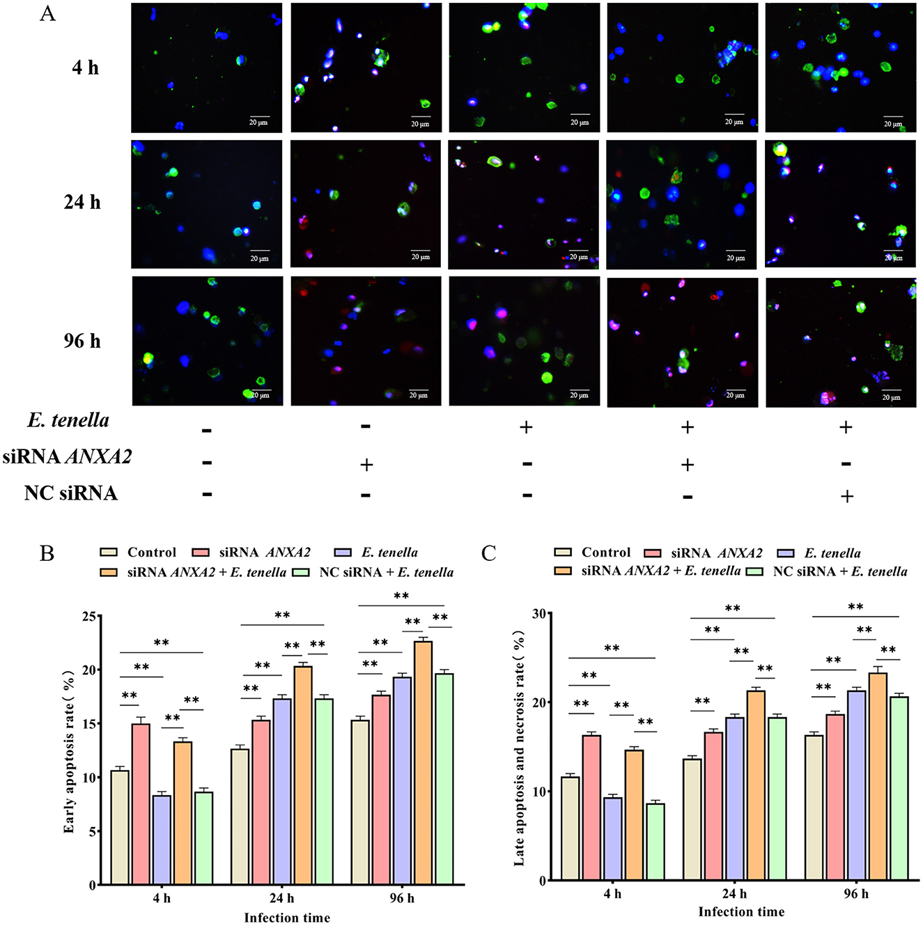 Panel A shows fluorescence microscopy images of cells at 4, 24, and 96 hours with various treatments, including E. tenella and siRNA ANXA2. Panels B and C display bar graphs indicating early apoptosis and late apoptosis or necrosis rates at different time points, with significant differences marked by asterisks.