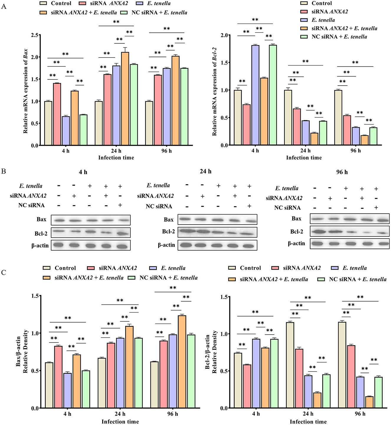 Graphs and images depict the expression levels of Bax and Bcl-2 genes at different infection times (4, 24, and 96 hours) under various conditions, including control, siRNA ANXA2, E. tenella, and combinations thereof. Graphs A and C show mRNA and protein expression levels, respectively, with significant differences marked by asterisks. Image B displays Western blot analyses for Bax, Bcl-2, and -actin, outlining the effects of differing treatments over time.