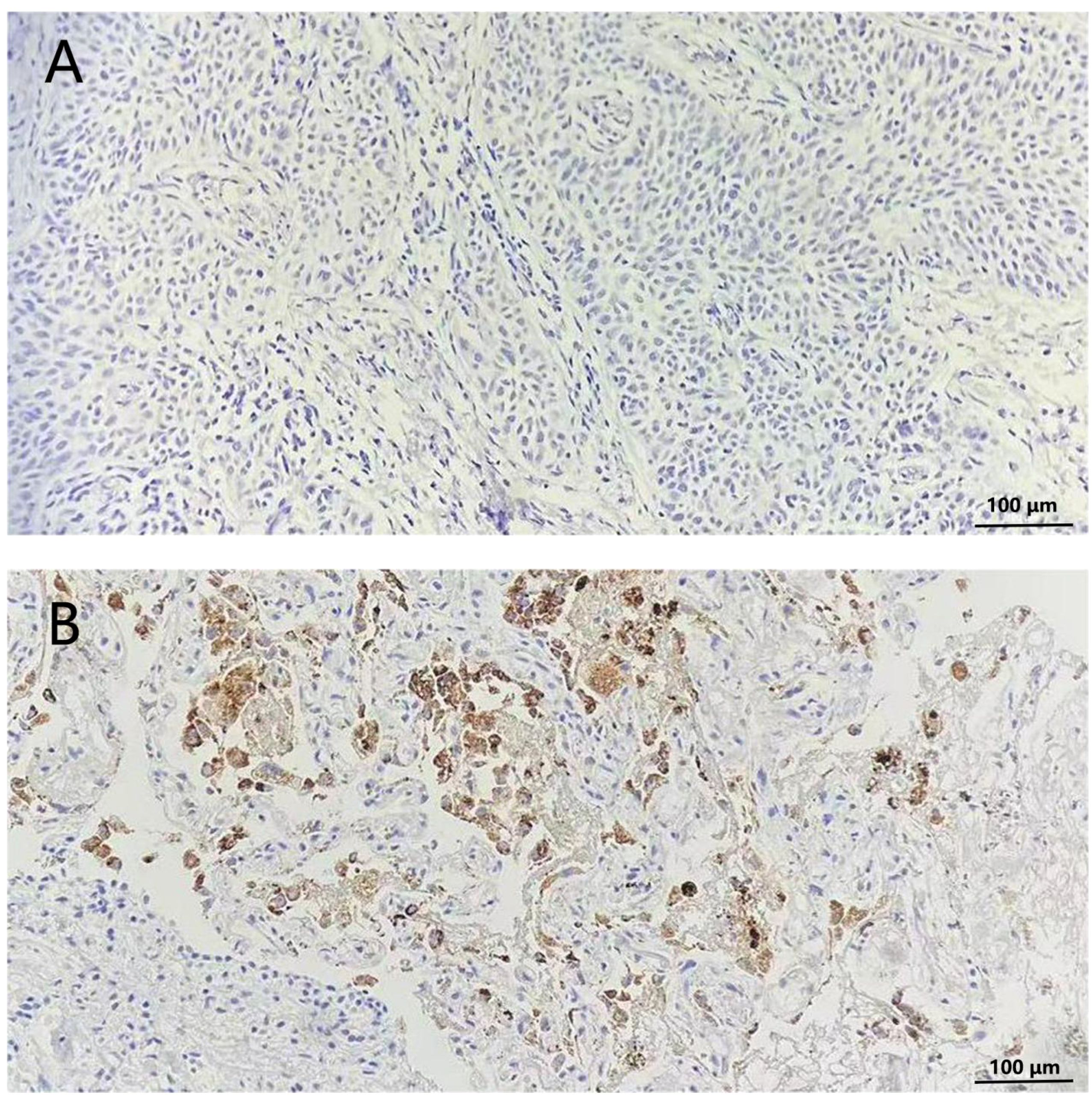 Histological images labeled A and B. Image A shows tissue with dense, uniform cells stained in light purple. Image B displays tissue with a similar background but includes additional brown-stained areas, indicating a different staining technique or cellular composition. Both images include a 100-micrometer scale bar.