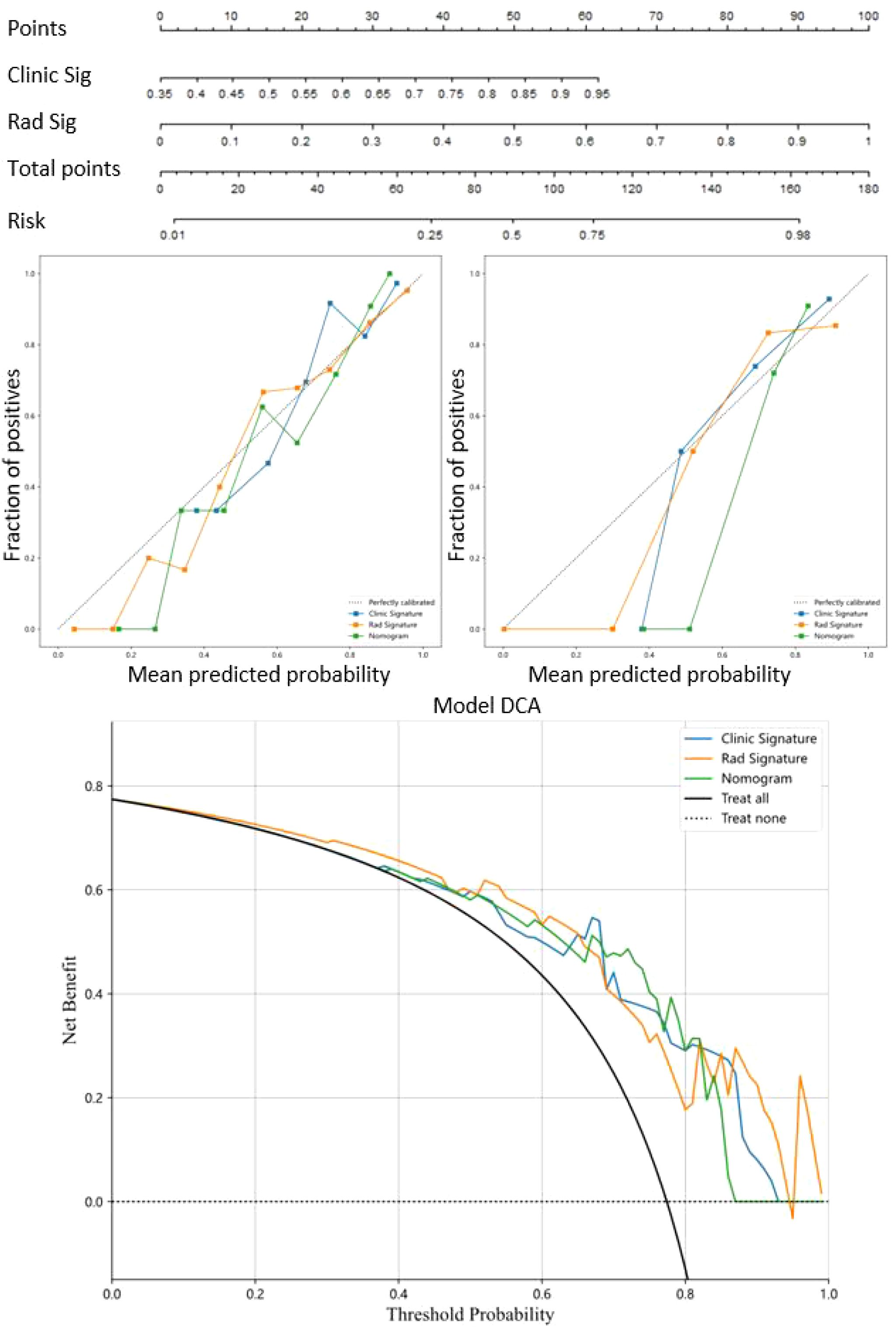 A visual representation composed of three main charts. The top section features a nomogram with variables including points, clinic signature, radiology signature, total points, and risk. The middle section contains two calibration plots, each showing the fraction of positives versus mean predicted probability, comparing clinic and radiology signatures, and nomogram with a perfectly calibrated line. The lower section presents a Decision Curve Analysis (DCA) chart, illustrating net benefit against threshold probability, comparing clinic signature, radiology signature, nomogram, treating all, and treating none.