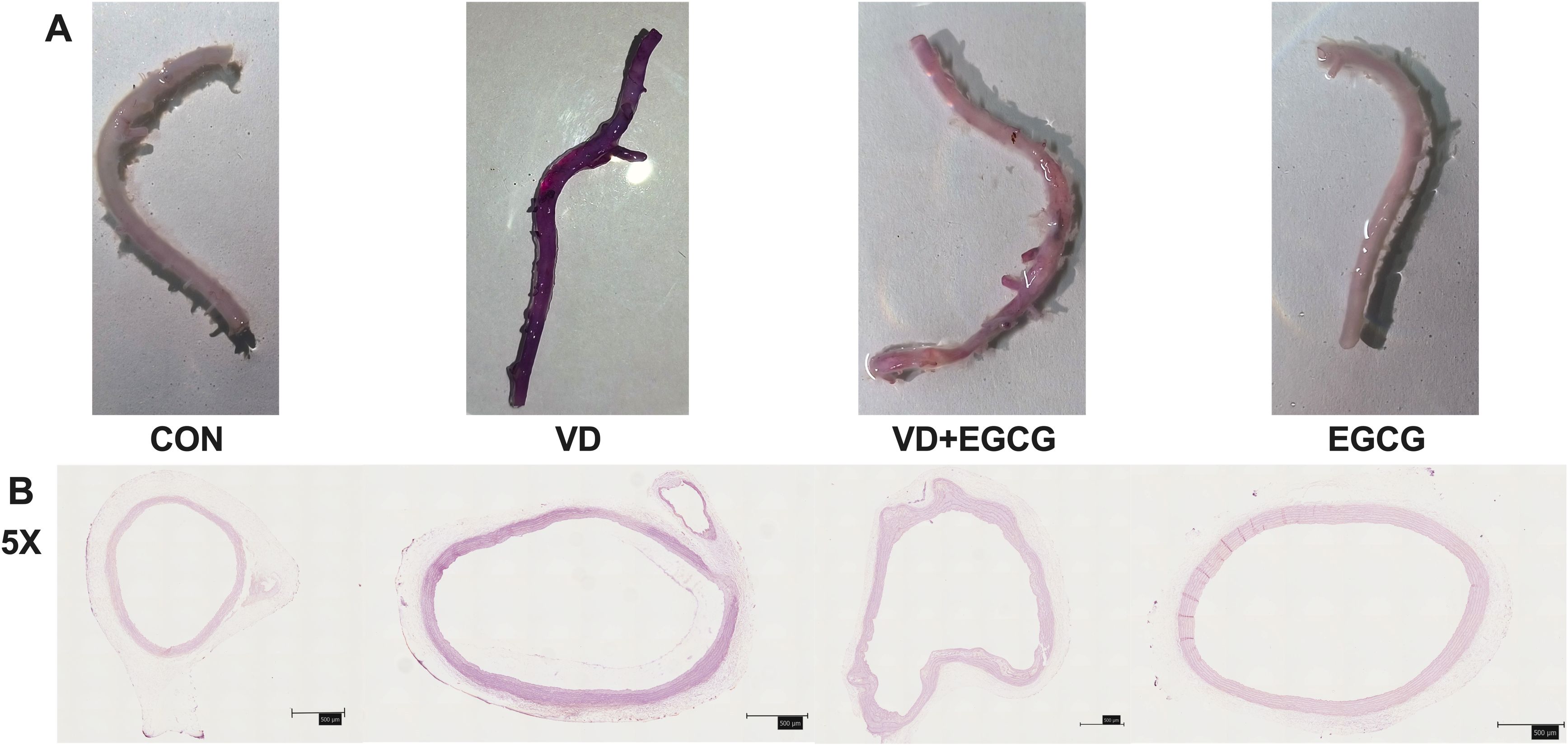 Panel A shows four different vascular tissues labeled as CON, VD, VD+EGCG, and EGCG, each varying in color and appearance. Panel B presents histological cross-sections of these tissues at five times magnification, highlighting structural differences.