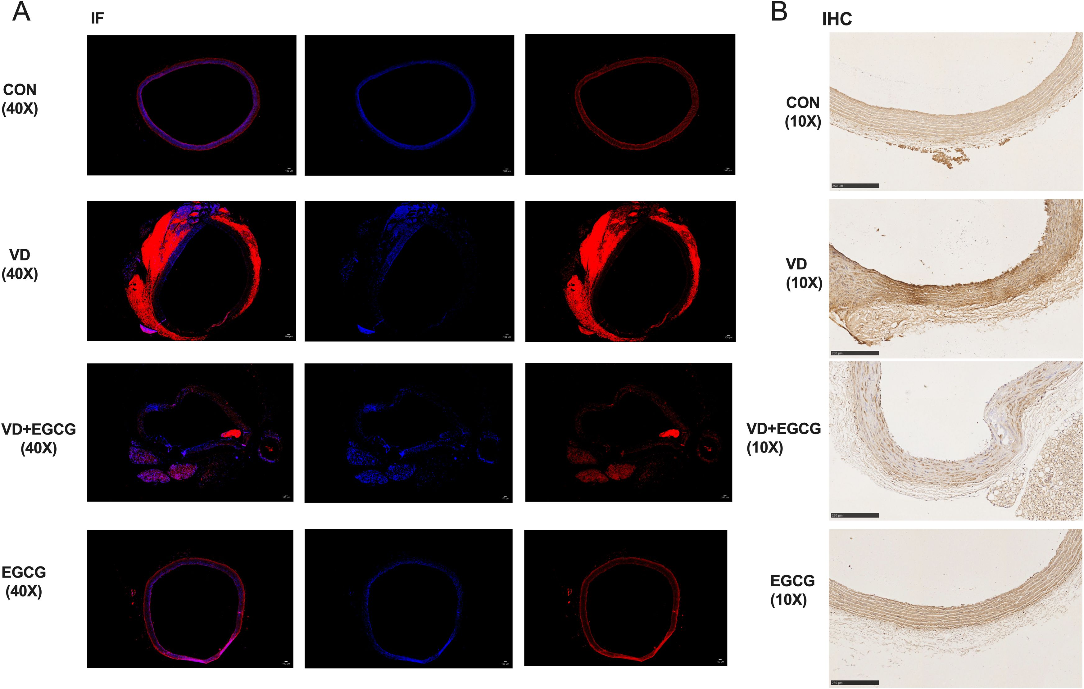 Panel A shows immunofluorescence (IF) images at 40x magnification under four conditions: CON, VD, VD+EGCG, and EGCG, featuring variations in color intensity and distribution. Panel B displays immunohistochemistry (IHC) images at 10x magnification under the same conditions, illustrating structural differences in tissue staining. Each row corresponds to a specific condition across the panels.