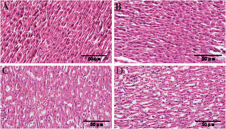 Histological images labeled A, B, C, and D show variations in cardiac muscle tissue under a microscope, stained in shades of pink and purple. Each panel depicts distinct cellular structures and staining intensity, with scale bars indicating 50 micrometers.