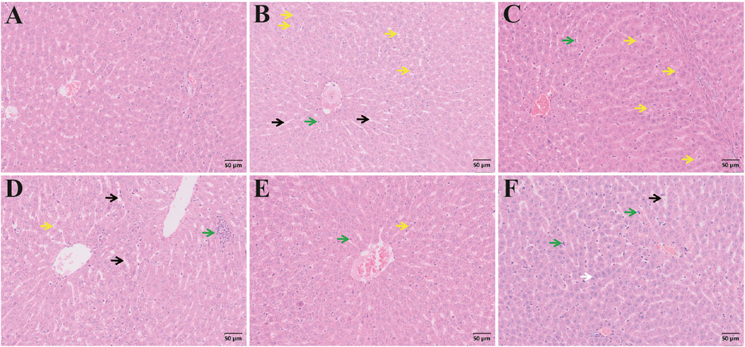 Microscopic images of liver tissue sections labeled A to F. Each section shows variations in cellular structures with color-coded arrows indicating specific features: black for structural elements, green for possible abnormalities, and yellow for tissue density variations. The scale bar is 50 micrometers.