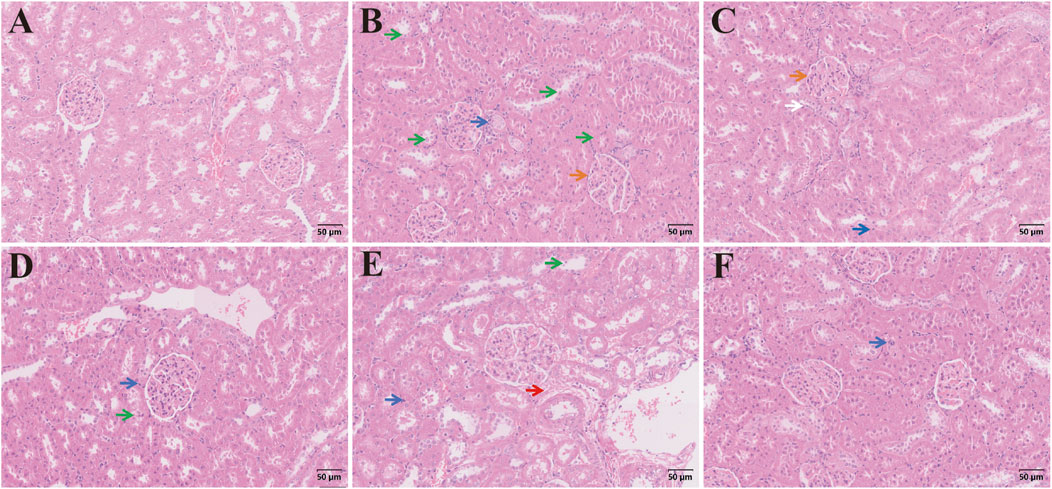 Microscopic images of kidney tissue sections labeled A to F, stained pink and purple. Different panels highlight various structures, with colored arrows indicating areas of interest. Each image is accompanied by a scale bar measuring fifty micrometers.