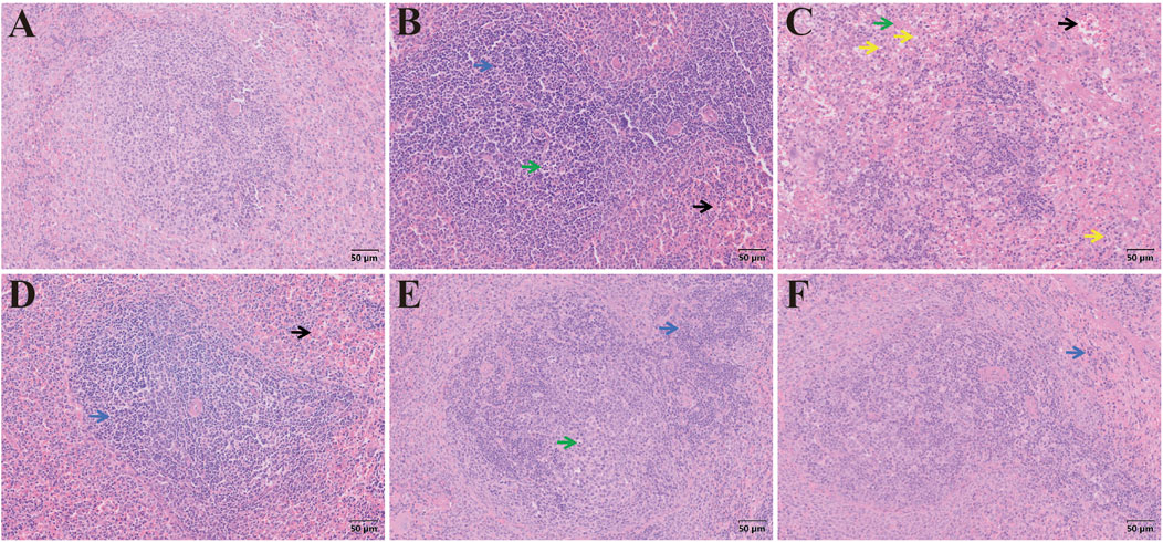 Microscopic images display tissue samples labeled A through F. Each sample shows varying degrees of cellular density and structure in shades of purple and pink, typical of hematoxylin and eosin staining. Arrows of different colors point to specific areas, possibly indicating features of interest or variation in cell types. Scale bars denote 50 micrometers for size reference.