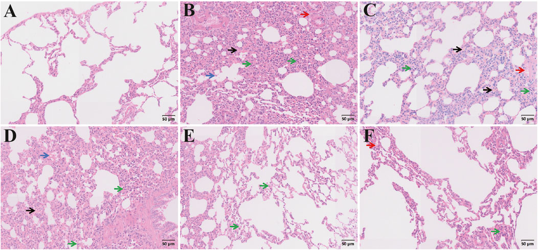 Histological images of lung tissues labeled A to F. Panel A shows normal alveolar structure. Panels B to D display increased cellular infiltration and disrupted alveoli with black, green, blue, and red arrows indicating specific features. Panels E and F exhibit less cellular infiltration with more distinct alveolar spaces. Each panel includes a scale bar indicating 50 micrometers.