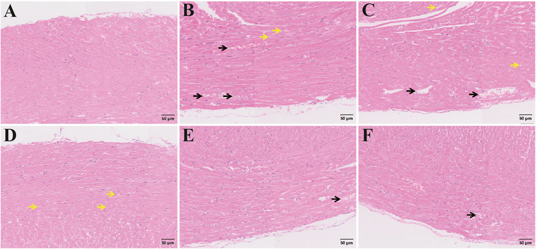 Histology micrographs of heart tissue from six panels labeled A to F. Each panel shows varying degrees of pink-stained cardiac muscle fibers. Black and yellow arrows indicate different structures or changes in the tissue. The scale in each image is 50 micrometers.