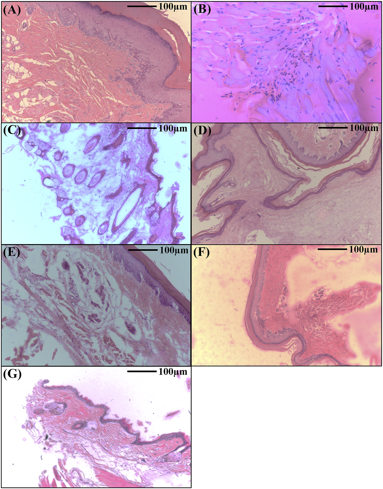 Histological images showing different tissue samples under a microscope. Panel A shows a layered tissue structure. Panel B features cellular formations with visible nuclei. Panel C displays glandular patterns. Panel D exhibits undulating tissue layers. Panel E shows fibrous textures. Panel F illustrates curved tissue structures on a pale background. Panel G presents an irregular tissue section with a mix of colors. Each panel includes a scale bar indicating one hundred micrometers for reference.