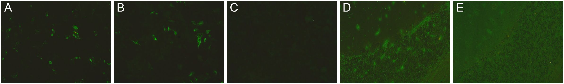 Fluorescence microscopy images labeled A to E. Each panel shows varying green fluorescence intensities on a dark background. Panel A and B display dispersed fluorescent spots. Panel C has minimal visible fluorescence. Panels D and E show more densely packed fluorescent areas, with increased fluorescence patterns towards the right side.
