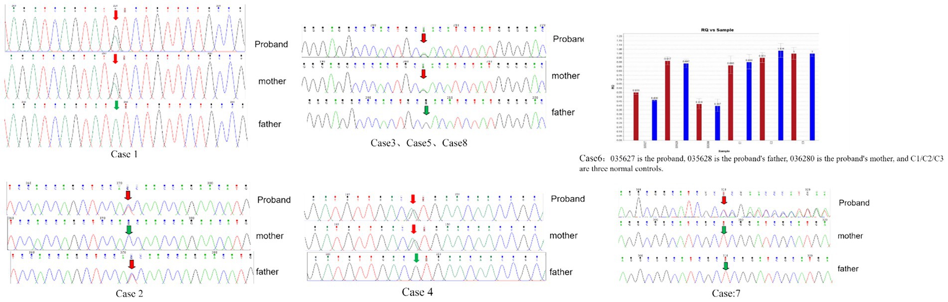 Genetic sequencing chromatograms display variations for several cases, labeled as Case 1, Case 2, Case 3, Case 4, and Case 7. Each case contains sequencing data for the proband, mother, and father. Red and green arrows highlight specific nucleotide changes. Additionally, a bar graph (Case 6) compares sample data, with proband values indicated alongside control samples.