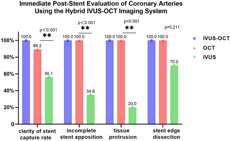 The hybrid system achieves 100% detection across all metrics: Clear stent capture rate (CSCR): Hybrid 100% vs. OCT 89.2% vs. IVUS 56.1%. Incomplete stent apposition: Hybrid 100% vs. OCT 100% vs. IVUS 34.8%. Tissue protrusion: Hybrid 100% vs. OCT 100% vs. IVUS 20%. Stent edge dissection: Hybrid 100% vs. OCT 100% vs. IVUS 70%.