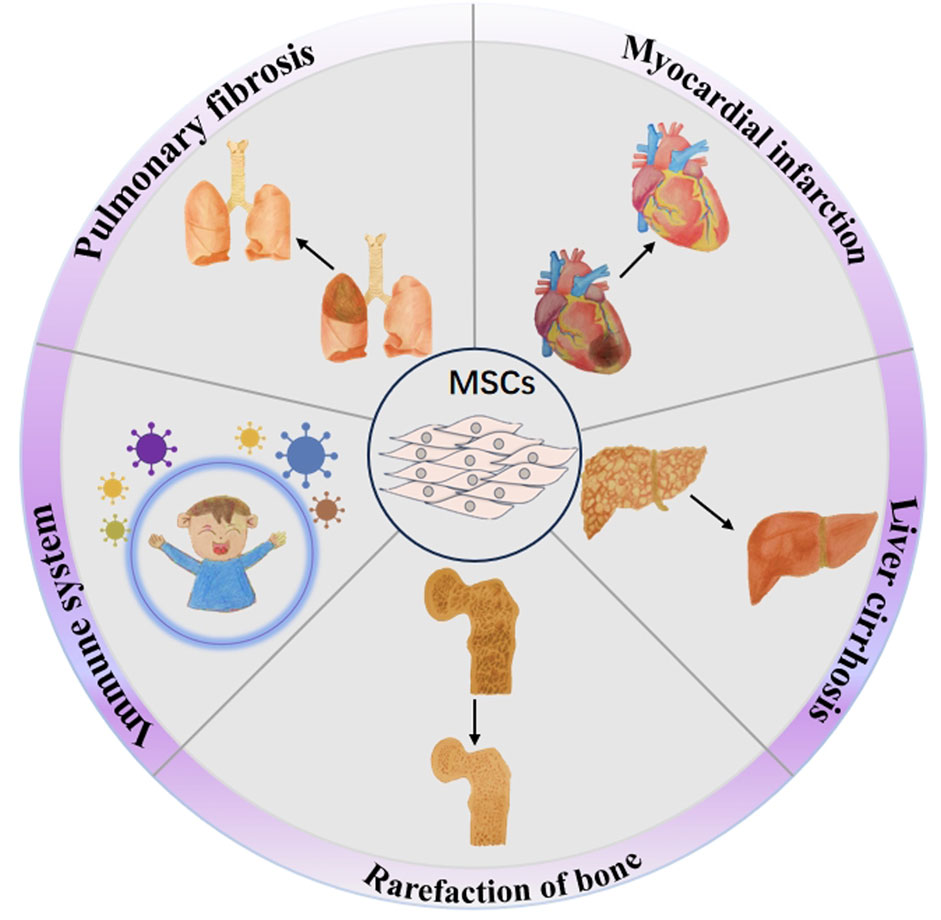 Illustration of mesenchymal stem cells (MSCs) at the center, connected to five conditions: pulmonary fibrosis, myocardial infarction, liver cirrhosis, rarefaction of bone, and immune system issues. Each condition is depicted with relevant organ images and arrows pointing to changes.