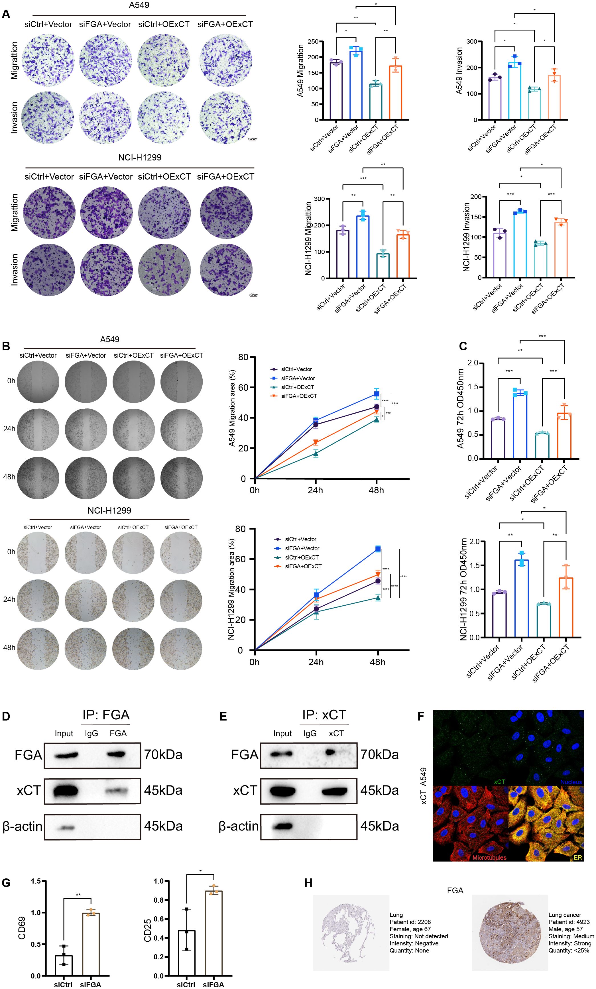 Research data presentation with multiple panels showing cell migration, invasion assays, and Western blots. A549 and NCI-H1299 cell lines are analyzed for migration, invasion, and protein interactions, with graphs indicating significant results. Immunofluorescence images display cellular structures, and histological images show lung cancer tissue staining comparisons. Each panel demonstrates experimental results related to siCtrl, siFGA, and OExCT treatments.