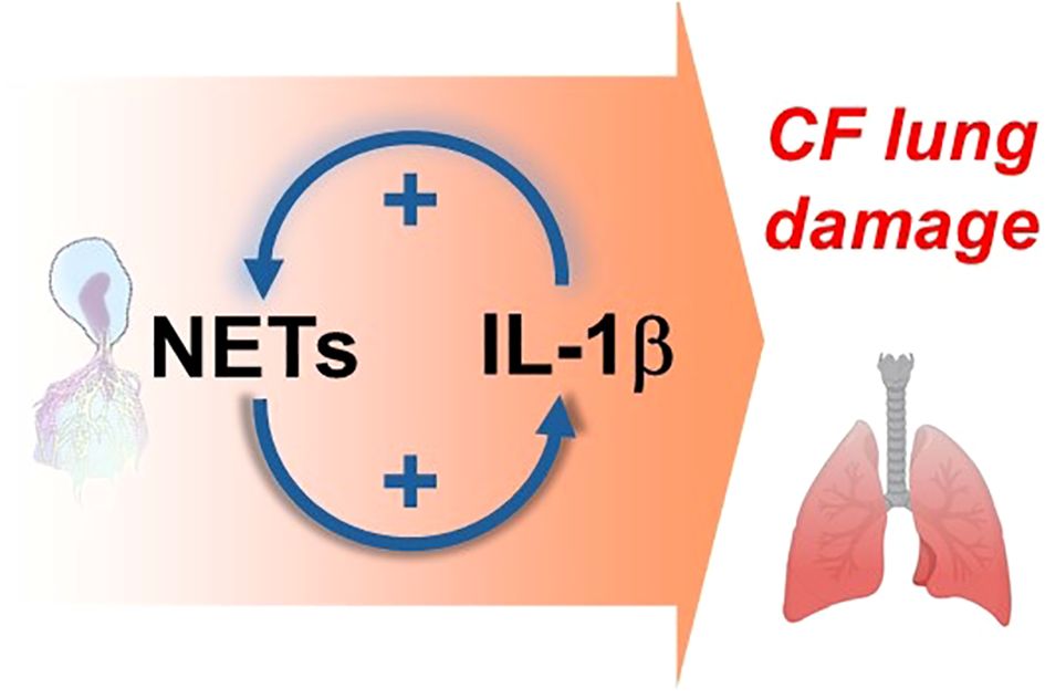 Diagram illustrating a cycle between NETs and IL-1β, with positive feedback arrows. To the right, it leads to “CF lung damage” with an image of lungs. The background is shaded in orange.