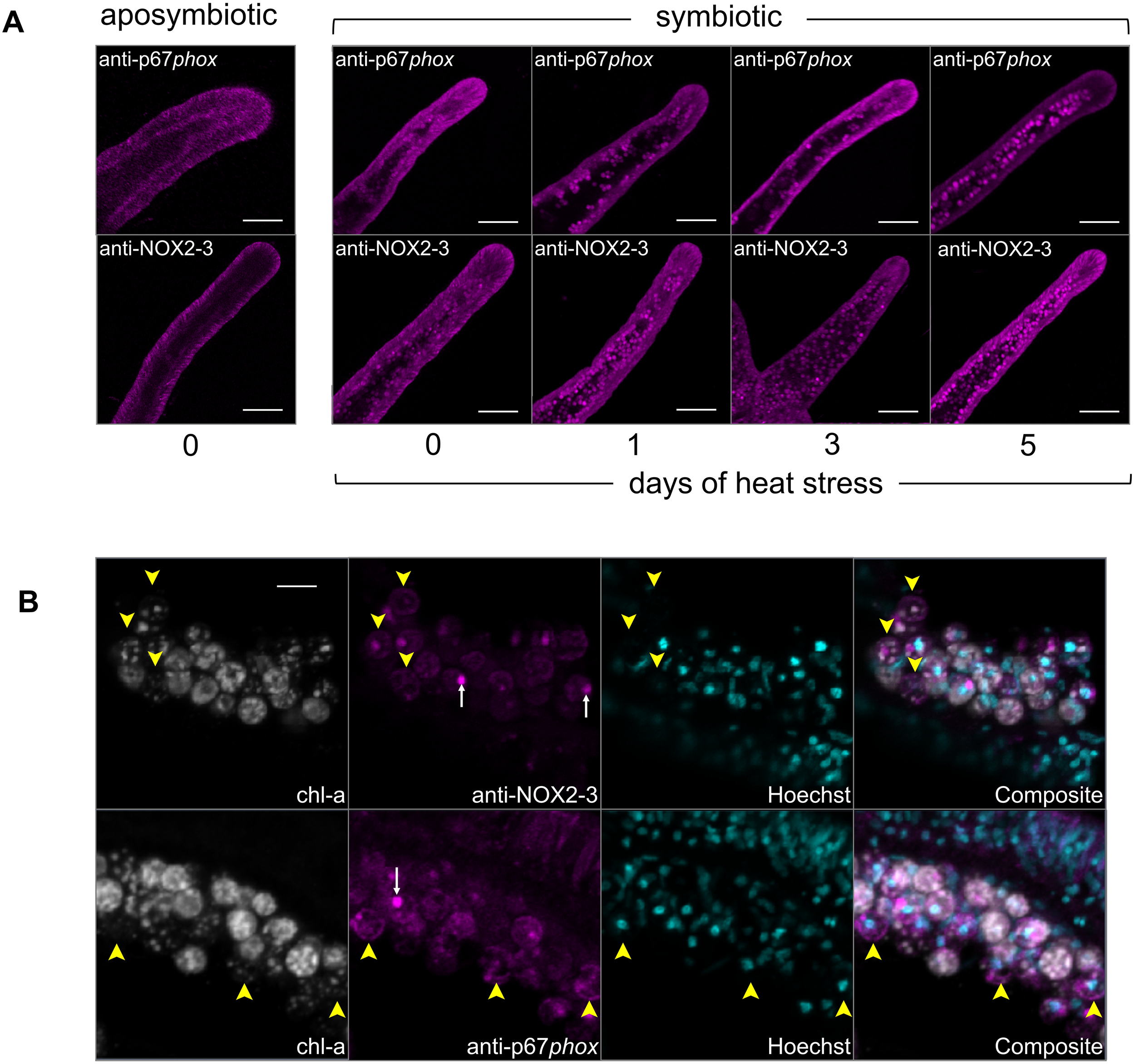 Panel A: 20× microscopy images of aposymbiotic and symbiotic tentacles stained with anti-p67phox and anti-NOX2-3 under heat stress at 0, 1, 3, and 5 days. Initially diffuse antibody signal in gastrodermal cells becomes concentrated near algal symbionts or possible symbiosomes over time. Panel B: Cryosections of symbiotic anemones on day 3 of heat stress show separate channels for chlorophyll-a, anti-NOX2-3, anti-p67phox, Hoechst, and composites. Arrowheads indicate localization of both antibodies at degraded algal symbionts and pyrenoids.
