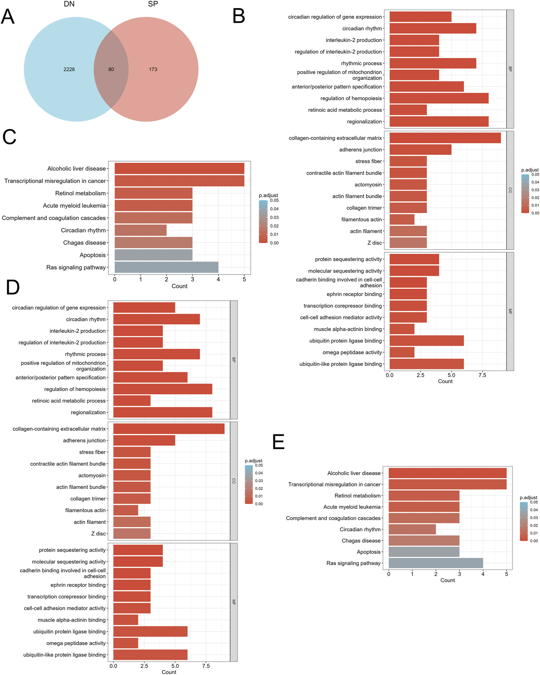 A composite image with five panels: A) A Venn diagram showing overlap between DN and SP categories, with 2,228 in DN only, 80 in both, and 173 in SP only. B, C, D, E) Bar graphs with enrichment analysis results for various biological processes and pathways. The bars are colored by adjusted p-values and vary in length. Categories include gene expression, metabolism, and disease associations like cancer and liver disease.Each panel highlights different pathway counts and their significance across groups, using color scales to indicate statistical significance.