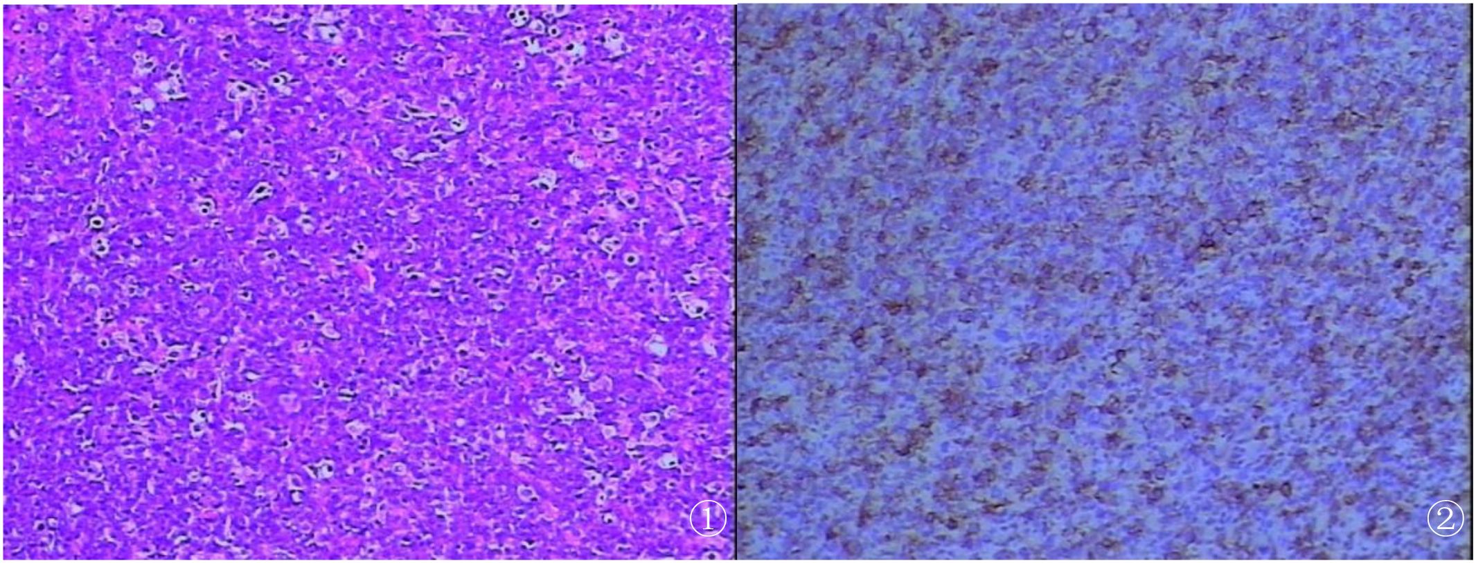 Two microscopic images side by side. Left image shows a bright purple tissue sample with visible cell structures, marked as ➀. Right image presents a blue-toned tissue sample with more subdued contrast, marked as ➁.