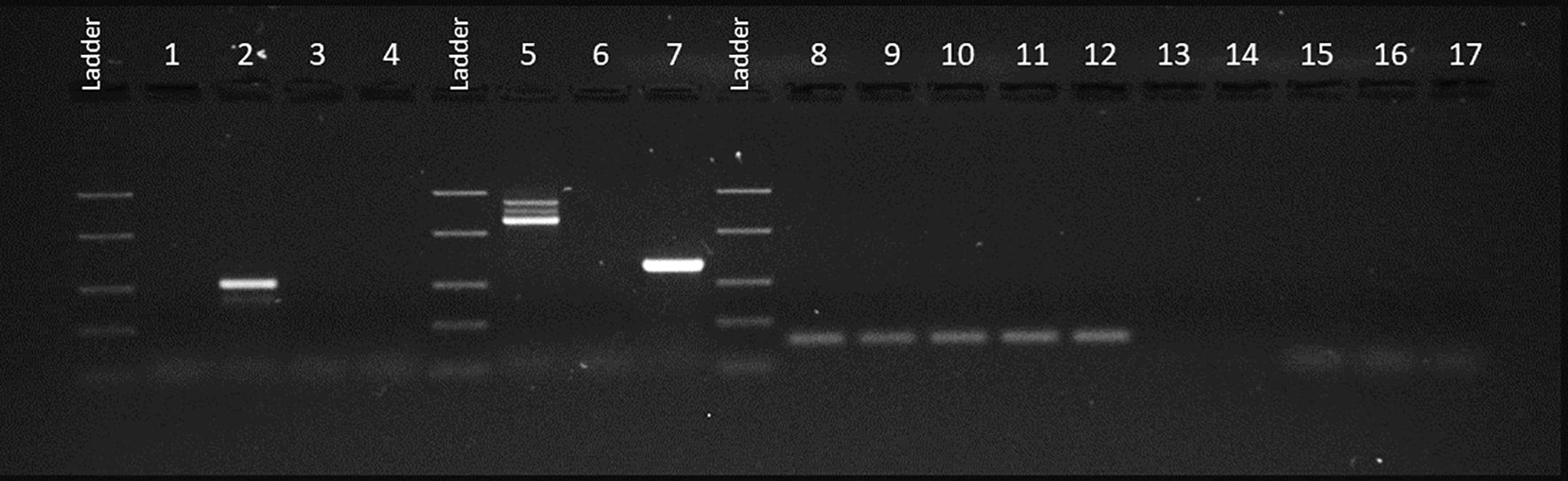Gel electrophoresis image showing DNA bands in lanes labeled 1 to 17, interspersed with DNA ladders. Noticeable bands appear in lanes 2, 5, 7, and 8-12, with ladder reference bands appearing brighter and stacked at specific intervals. Other lanes depict no visible bands.